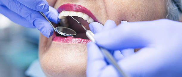 Best Dentist for Tooth Abscess  in Archbold, OH